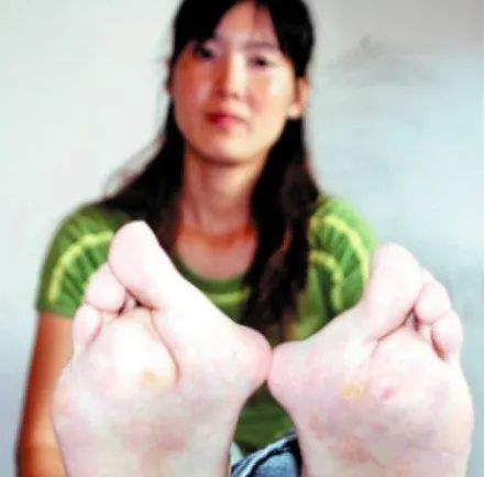 这次举重冠军是哪位运动员_举重运动员顺序_举重运动员称重规则